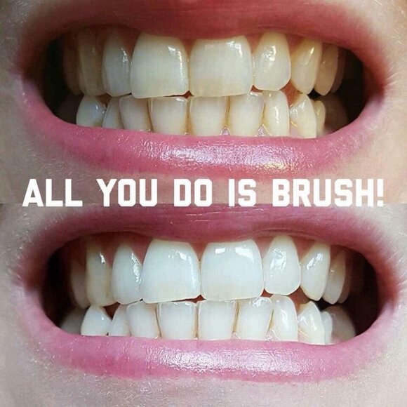 AP24 Whitening Toothpaste - Picture 4 of 8